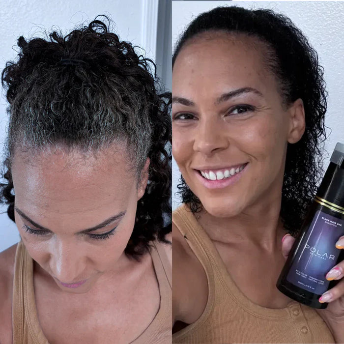 Antes y después