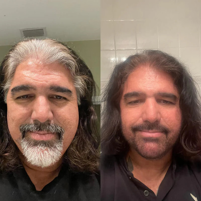 Antes y después