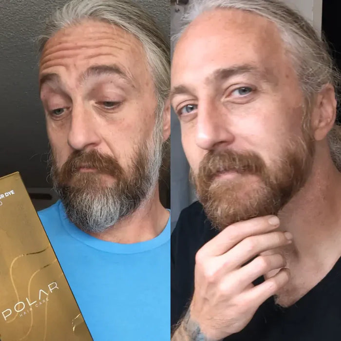 Antes y después