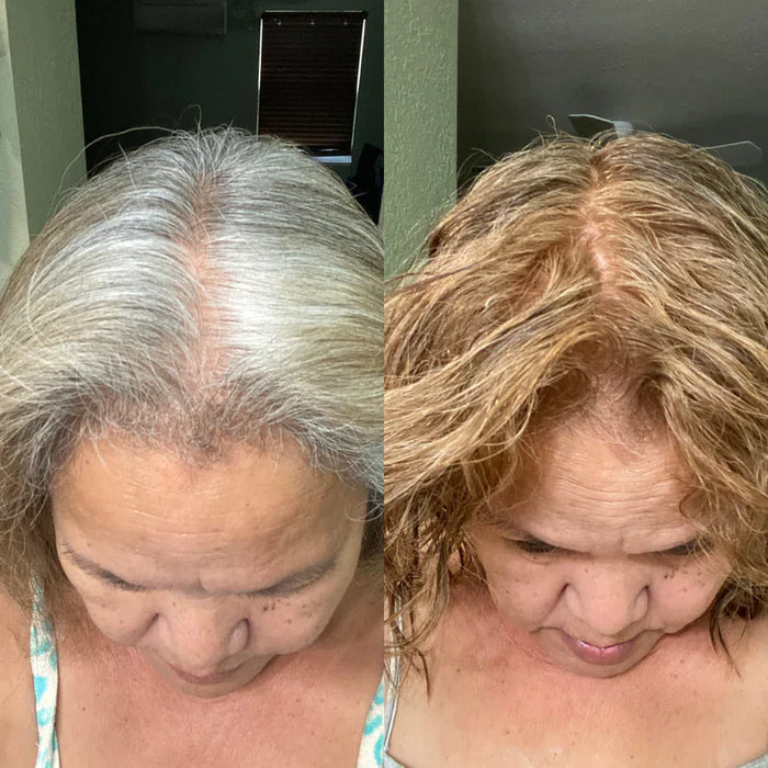 Antes y después