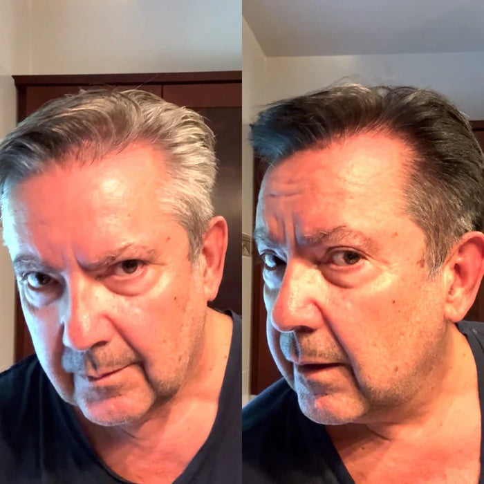 Antes y después